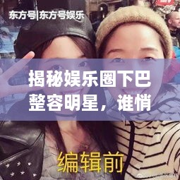 揭秘娛樂圈下巴整容明星，誰悄悄整過下巴？