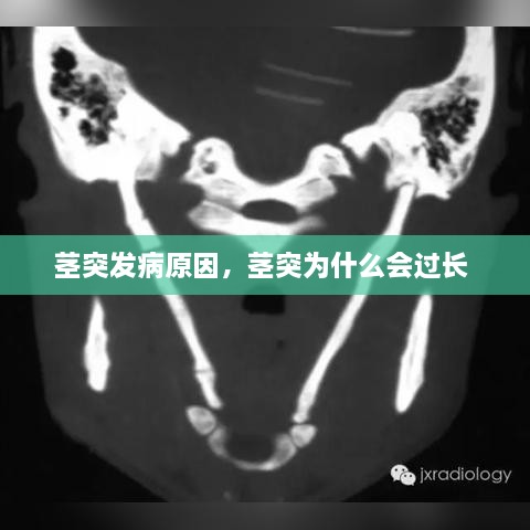 莖突發(fā)病原因，莖突為什么會過長 