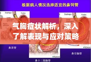 氣胸癥狀解析，深入了解表現(xiàn)與應(yīng)對策略