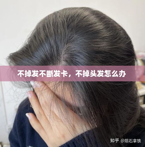 不掉發(fā)不斷發(fā)卡，不掉頭發(fā)怎么辦 