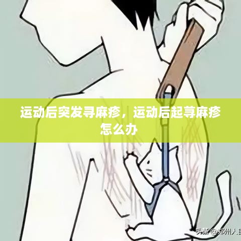 運動后突發(fā)尋麻疹，運動后起蕁麻疹怎么辦 