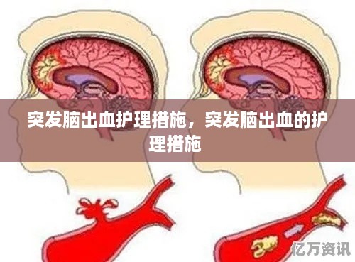 突發(fā)腦出血護(hù)理措施，突發(fā)腦出血的護(hù)理措施 