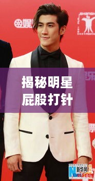 揭秘明星屁股打針背后的真相、誤解與公眾關(guān)注焦點(diǎn)