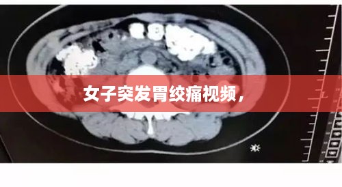 女子突發(fā)胃絞痛視頻， 