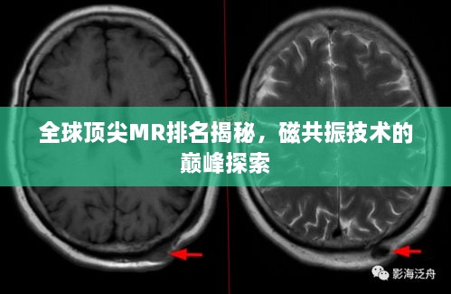 全球頂尖MR排名揭秘，磁共振技術(shù)的巔峰探索