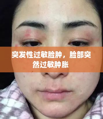 突發(fā)性過敏臉腫，臉部突然過敏腫脹 