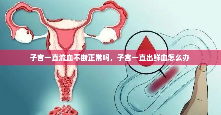 子宮一直流血不斷正常嗎，子宮一直出鮮血怎么辦 