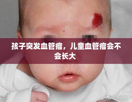 孩子突發(fā)血管瘤，兒童血管瘤會不會長大 