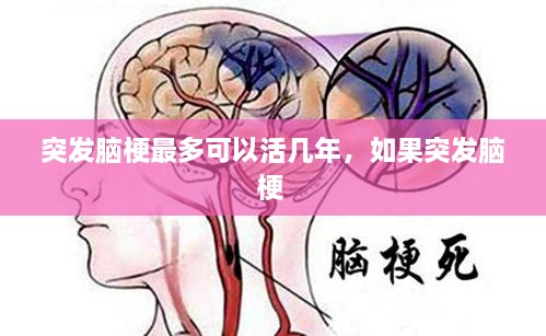 突發(fā)腦梗最多可以活幾年，如果突發(fā)腦梗 