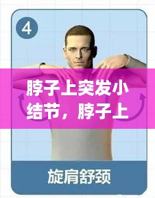 脖子上突發(fā)小結(jié)節(jié)，脖子上的小結(jié)節(jié)要緊嗎 