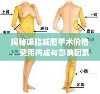 揭秘吸脂減肥手術(shù)價(jià)格，費(fèi)用構(gòu)成與影響因素全解析